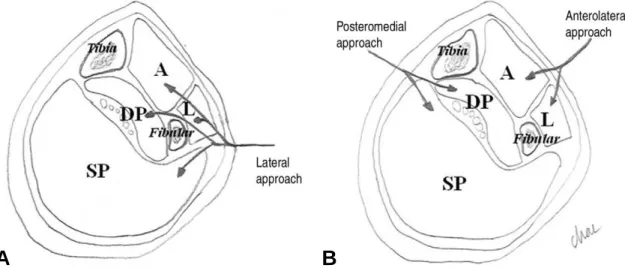 Figure 2. Schematic drawing of anatomical section view of the lower leg. (A) single lateral approach
