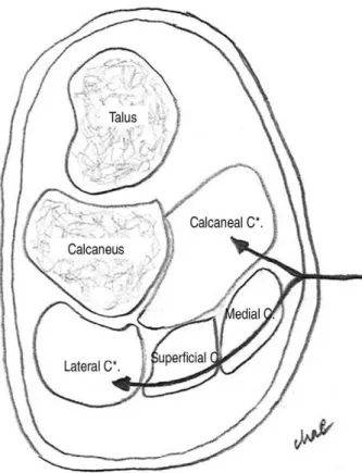 Figure 4. Schematic drawing of anatomical section view of the hindfoot. The plantar medial approach allow acess to the calcaneal compartment