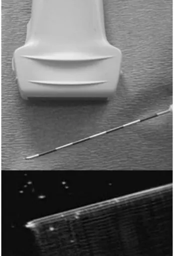 Fig. 11. 23 G, 10cm needle(arrowheads) is introduced by use of real-time in-plane ultrasound  guid-ance to target point, which is groove at root of transverse process and base of superior  artic-ular process.