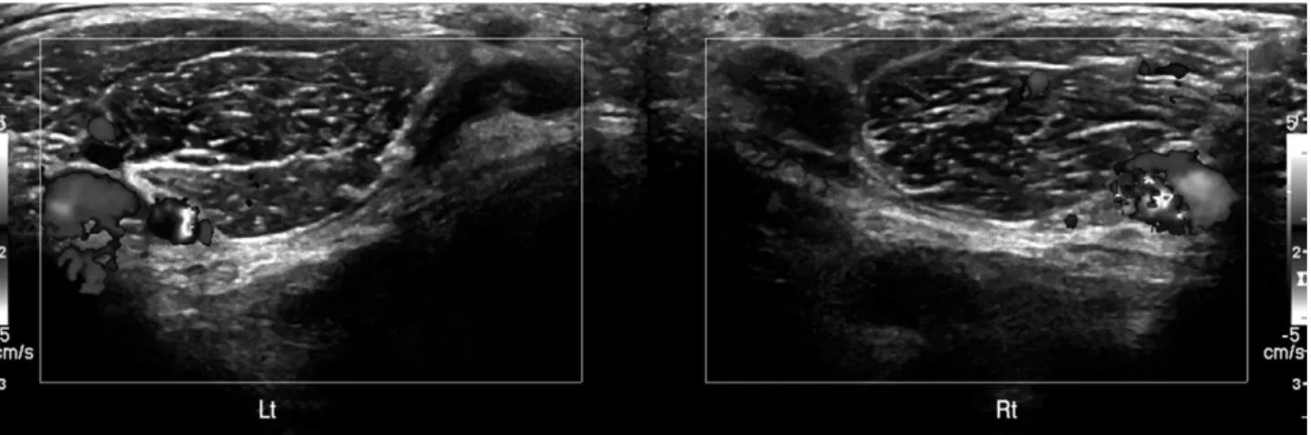 Fig. 5. MRI show nonspecific finding at 5 weeks fol- fol-lows up.