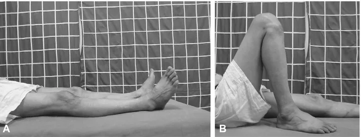 Fig. 4. Photographs show full range of motion at 2 years of follow-up with (A) full extension and (B) full flexion.