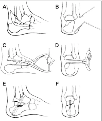 Figure 4. Procedure of operation.