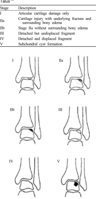 Figure 3. MRI staging of osteochondral lesion of the talus. 15)