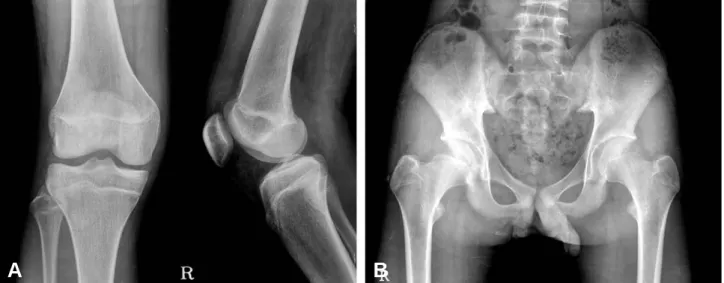 Fig. 2. Anteroposterior and lateral radiographs from immediate postoperative scan confirming transphyseal tunnel placement and hardware away from physes.