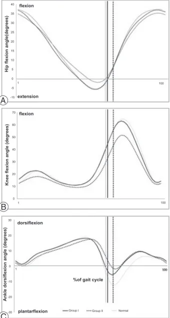 Fig. 2. Comparison of hip (A), knee (B), ankle (C) sagittal  plane moment between groups