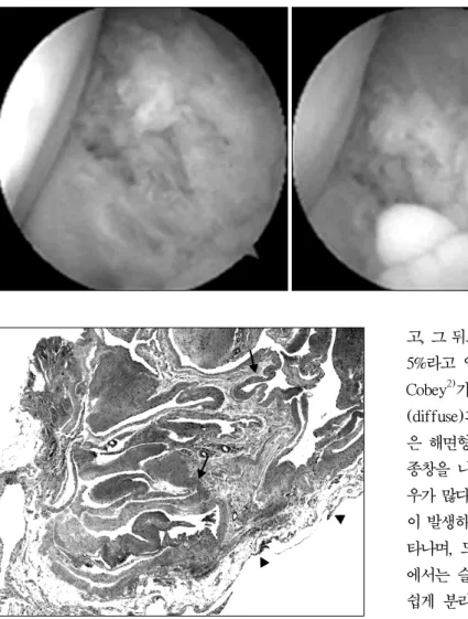 Fig. 4. Post-resection view.