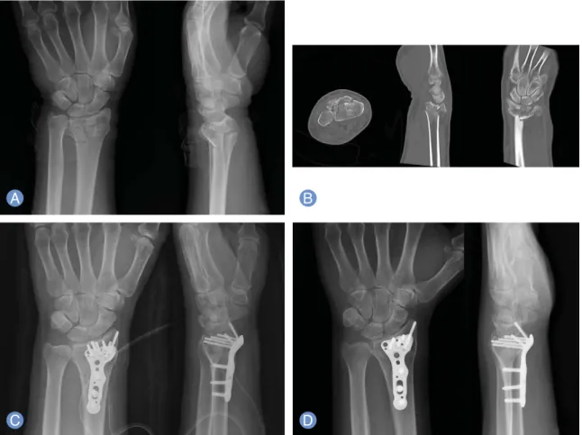 Table 3. Results according to the radiographic evaluation