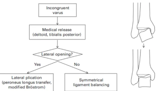 Figure 1. Diagram and algorithm showing ligament balancing in the  incongruent varus ankle (Kim BS, Choi WJ, Kim YS, Lee JW