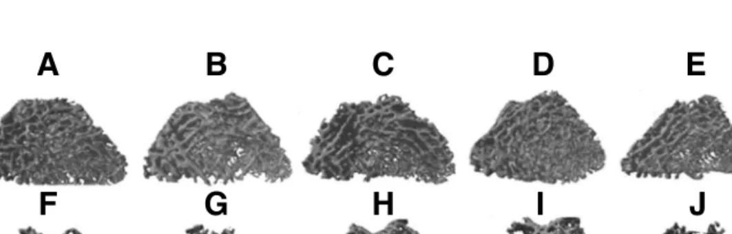 Fig. 2. 3D micro-CT reconstruction models of the volume of interest (VOI) of cancellous bone of distal femur of five rats each, in the ALD group (A, B, C, D, E) shown in blue, and the OVX group (F, G, H, I, J) shown in green