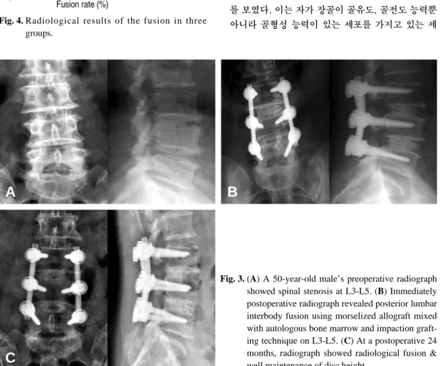 Fig. 4. Radiological results of the fusion in three groups.