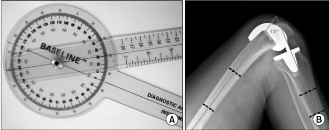 Fig. 2. Estimation of the fle- fle-xion angle of the knee and the angle  measured  using  a   stan-dard  2-arm  Goniometer  (12-  inch arms with 1 o  markings)  (A)