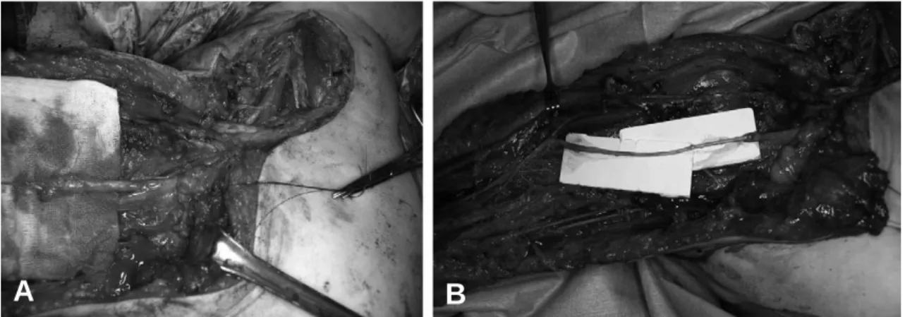 Fig. 6. At post operative 2 years, active extension of wrist (grade 4/5) and flexion of elbow (grade 4/5) were possible