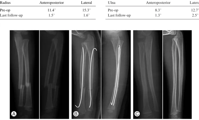 Table 1. Results of angular deformity in the radius 
