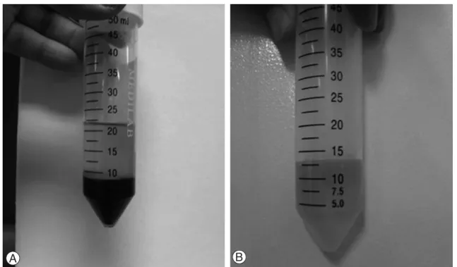 Fig. 1. (A) Three layers of plasma, buffy coat and red blood cells after 1 st centrifugation under 3200 rpm (B) Two lay- lay-ers of PPP (Plasma Poor Plasma) and PRP (Platelet Rich Plasma) after 2 nd centrifugation under 5000 rpm.