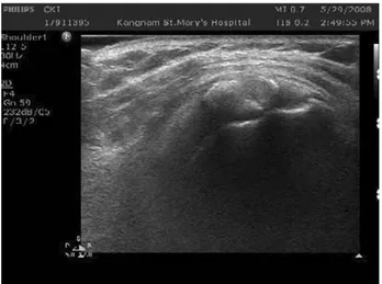 Fig. 6. Initial sonography showing a few large hypere- hypere-choic calcified mass.
