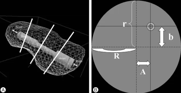 Fig. 1. (A) Proximal, middle, distal portions of the scaphoid. (B) The distance from the center of the scaphoid to the center of the screw and the diameter of the scaphoid were measured from sagital and coronal reconstructive computed tomographic images.