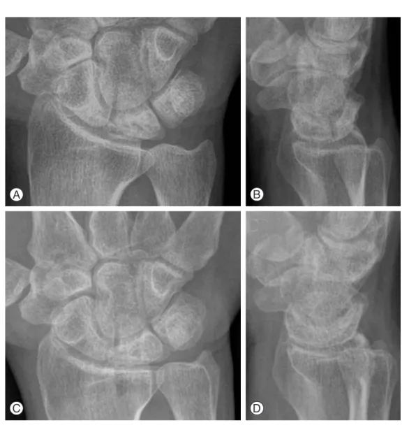 Table 2. Radiographic and clinical Results