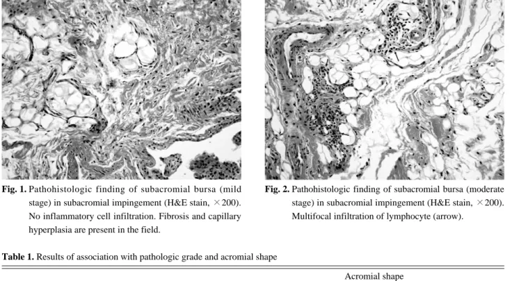Fig. 2. Pathohistologic finding of subacromial bursa (moderate stage) in subacromial impingement (H&amp;E stain, ×200).
