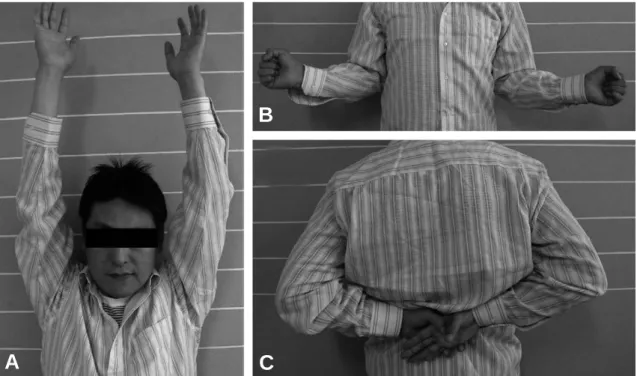 Fig. 2. Photographs of the both shoulder obtained 24 months after operation. (A) 170 degrees of forward flexion