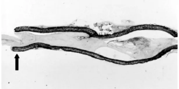 Fig. 1. Schematic drawing of the experimental proce- proce-dure for injecting PDGF.