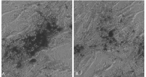Fig. 3. Osteoblast-specific gene expression in RT-PCR.  Type I collagen, Osteocalcin and Osteopontin in RT-PCR increased by the 3 rd &amp; 4 th weeks after the induction of osteogenesis.