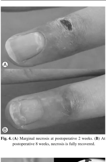 Fig. 4. (A) Marginal necrosis at postoperative 2 weeks. (B) At postoperative 8 weeks, necrosis is fully recovered.