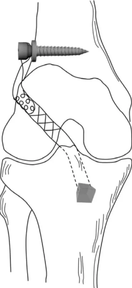 Fig. 2. One third of Achilles tendon was made into  ‘tube’