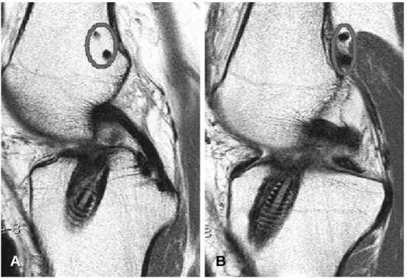 Fig. 6. Direction of the cross pin in the axial view.