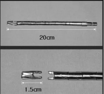 Fig. 2. The photography shows notchplasty with the flexible reamer in the hyper extension of the knee.