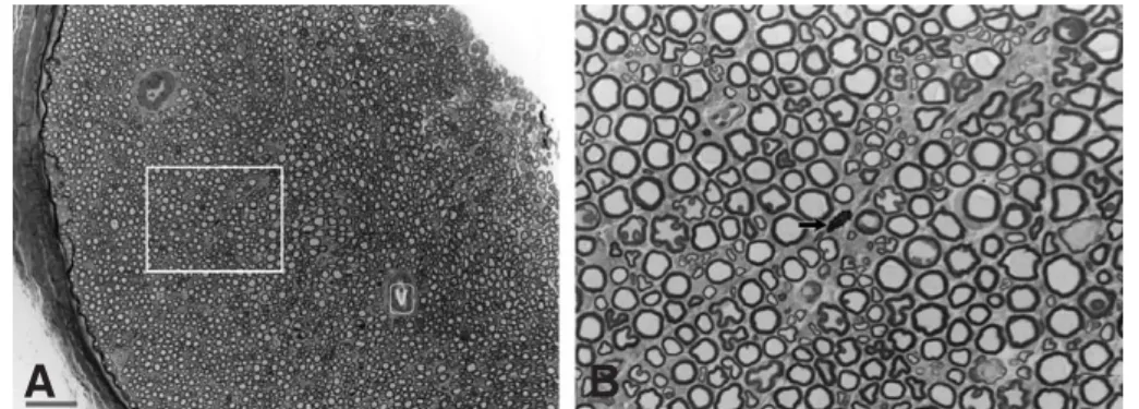 Fig. 1. Light microscopic findings of the transverse section of normal rat sciatic nerve