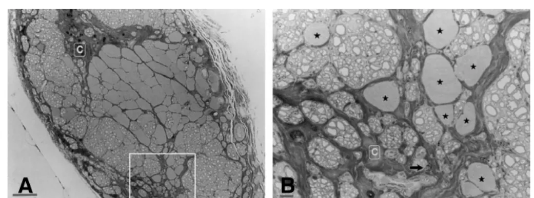 Fig. 3. Light microscopic findings of the longitudinal sections from the rat sciatic nerves 12 months after surgical operation