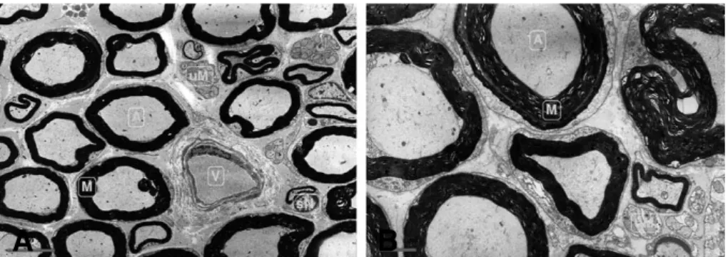 Fig. 5. Electron microscopic findings of the transverse sections from the rat sciatic nerve 12 months after surgical operation