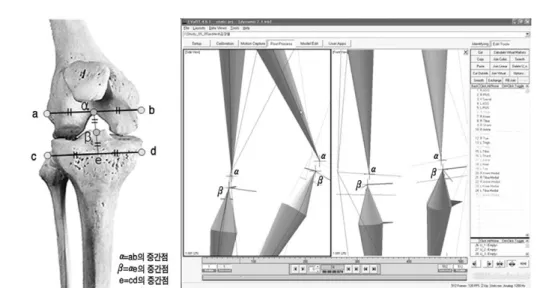 Fig. 2.  Generation of virtual markers. Using the 4 real markers around the knee, 2 virtual marker were generat- generat-ed, one at the intercondylar notch of femur ( α), and the other at the tibial spine (β).