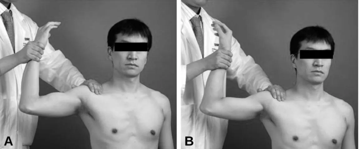 Fig. 7. Forced abduction test
