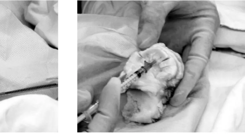 Fig. 1. Fresh frozen allogenic meniscus divided into 5 pieces. 1 for control group, 3 for experimental group and 1 for another experiment.