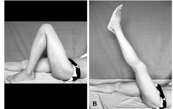 Fig. 5. (A) At 1 year after surgery, the patient shows no restriction of range of motion in the hip and knee