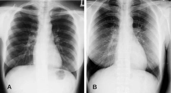 Fig. 2. 40-year old man with back pain during playing golf.