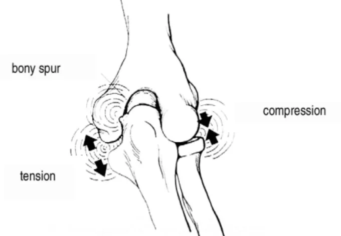 Fig. 1. Relationship of the biomechanical forces within the elbow during throwing.