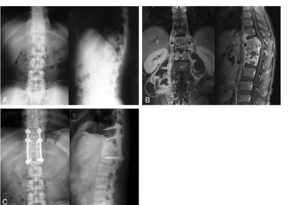 Table 3. Radiological and clinical results in the 14 patients