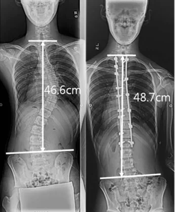 Fig. 1. Trunk length measurement.