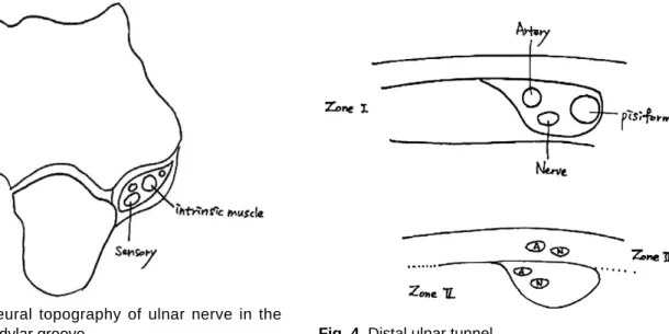 Fig. 3. Intraneural topography of ulnar nerve in the