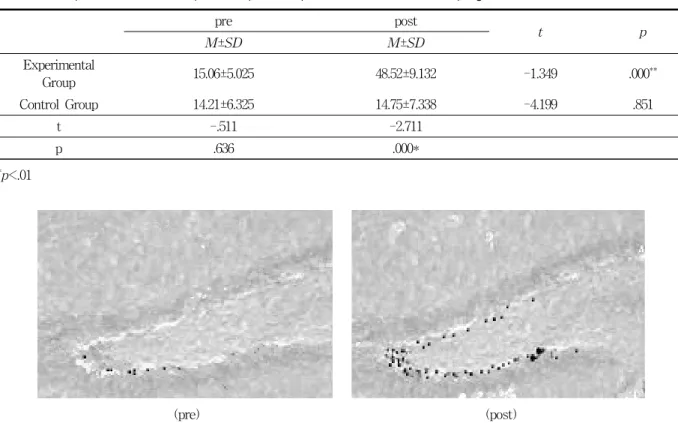 Figure  1.  Effect  of  Combined  Exercise  program  on  cell  expression  in  th  Hippocampus