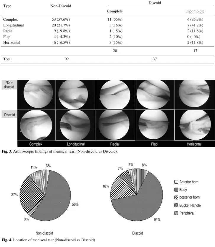 Fig. 4. Location of meniscal tear (Non-discoid vs Discoid)