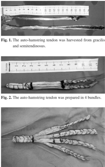 Fig. 1. The auto-hamstring tendon was harvested from gracilis and semitendinosus.