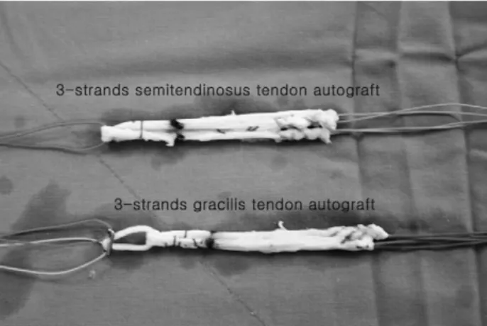 Fig. 1. Hamstring tendon autograft.