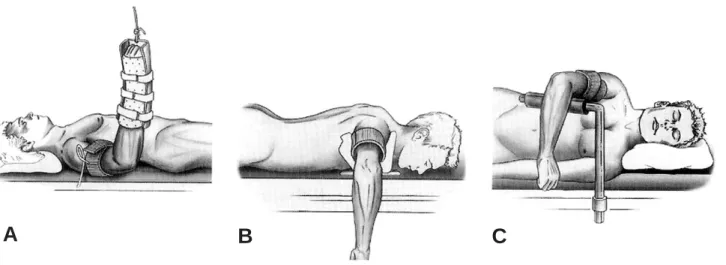 Fig 1. 주관절 관절경의 환자 위치.