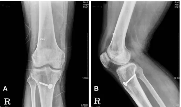 Fig. 3. Post-operative radiographs.