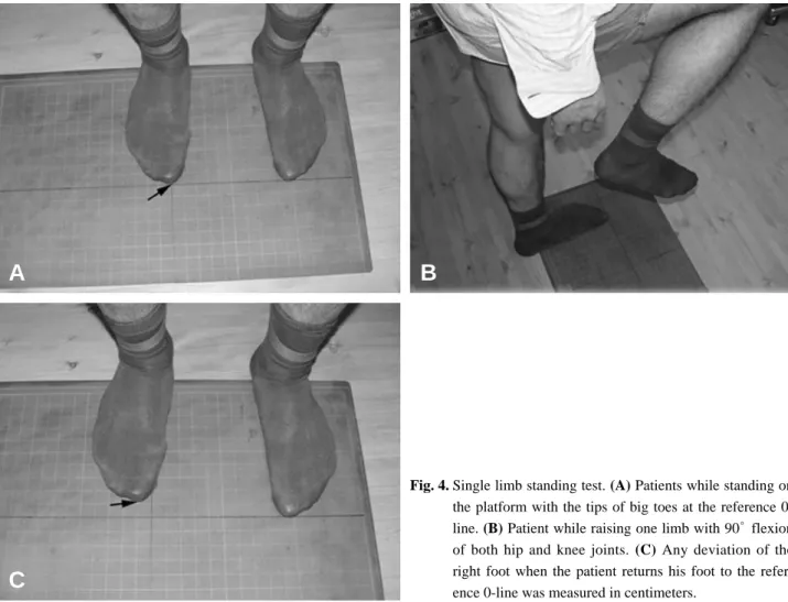 Fig. 4. Single limb standing test. (A) Patients while standing on the platform with the tips of big toes at the reference  0-line