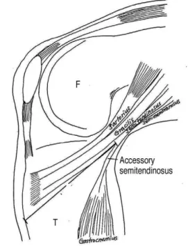 Fig. 1. Closeup photograph was showed the tendon separation of conjoined tendon