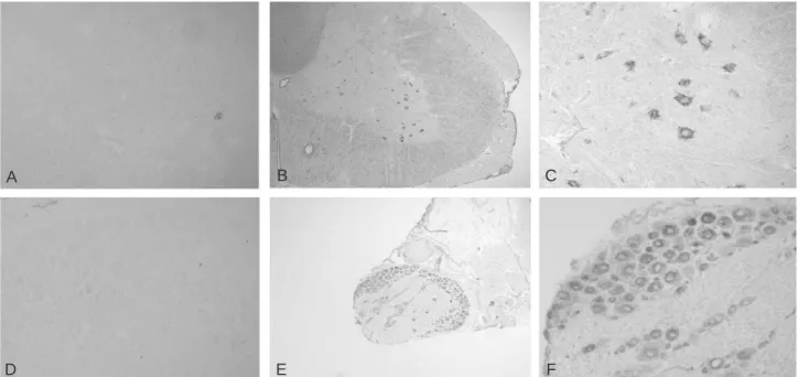Fig. 1. Localization of TEM7 mRNA in the spinal cord and dorsal root ganglion. (A) Sense probe did not label any structures in the spinal cord